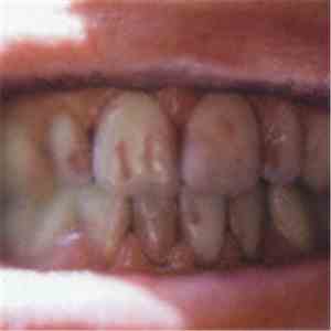 31 Knots - Talk Like Blood mp3 album