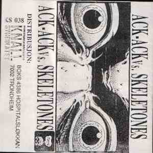 Ack-Ack Vs Skeletones - Ack-Ack Vs Skeletones mp3 album