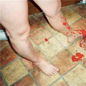 Hypochristmutreefuzz + It It Anita - The Split mp3 album