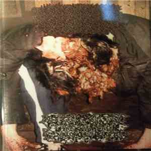 Ecthyma Gangrenosum VS Hyperplasia And Metaplasia In Necrotizing Enterocolitis - Split mp3 album