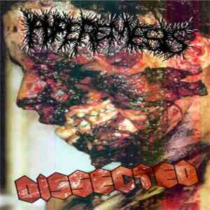 Hyperemesis / Dissected - Hyperemesis / Dissected mp3 album