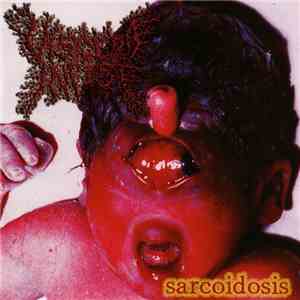 Viscera Infest - Sarcoidosis mp3 album